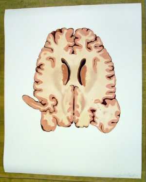 TMSFoto/PK/MB 2012-25 (PK).jpg