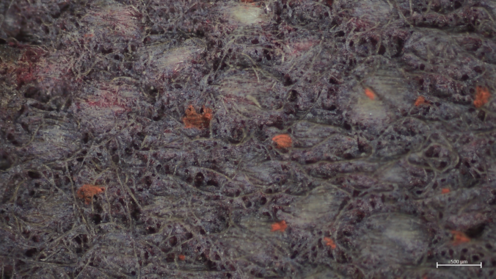 Beeld door microscoop - detail opname van de beschadiging. Dr. Rika Pause, Museum Boijmans Van Beuningen